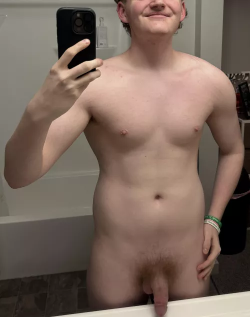 21(m) used to be obese so I hope you don’t mind my stretchmarks