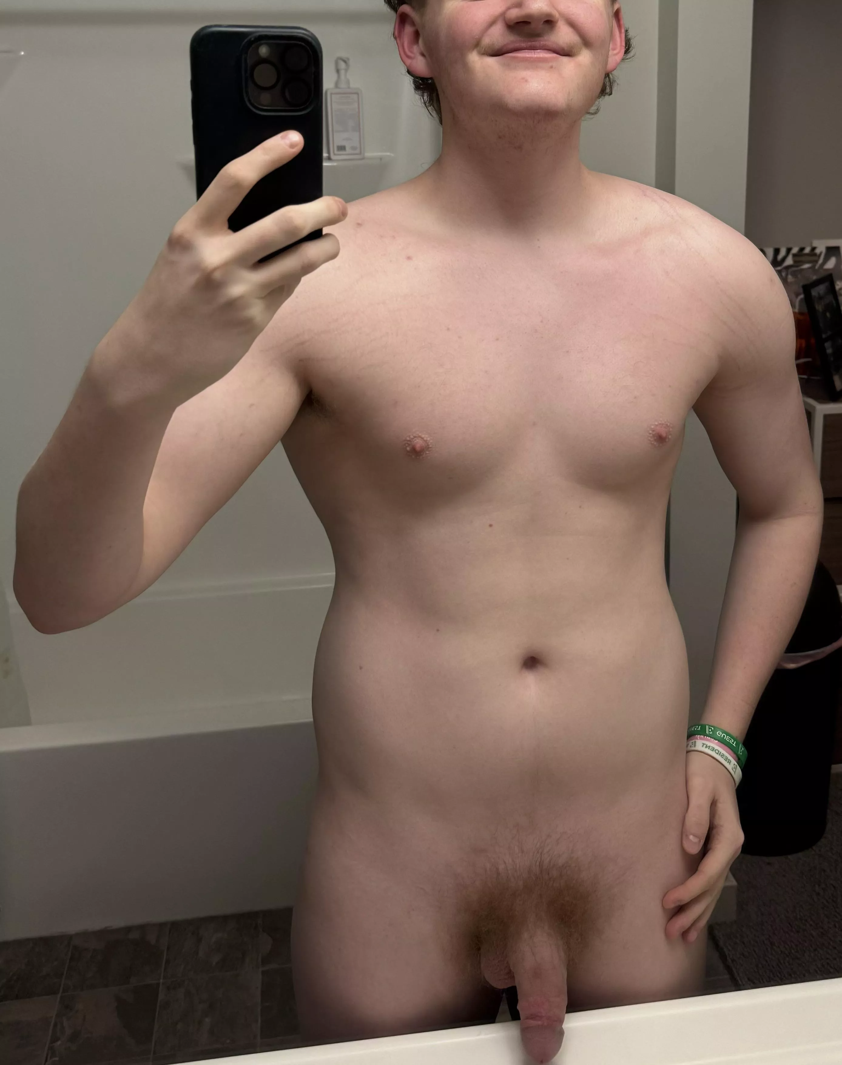 21(m) used to be obese so I hope you don’t mind my stretchmarks