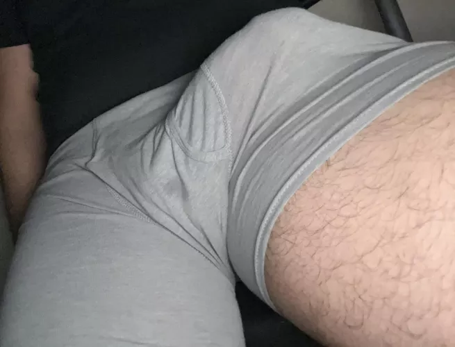 Bulging dm me