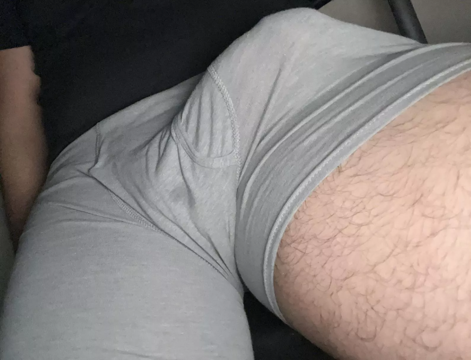Bulging dm me