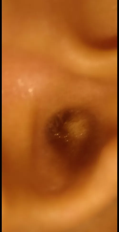 Is it a ear infection feeling pain in ear in loud noises 