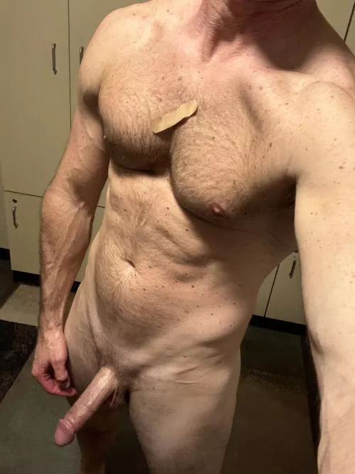 Don’t mind the bandaid (37)