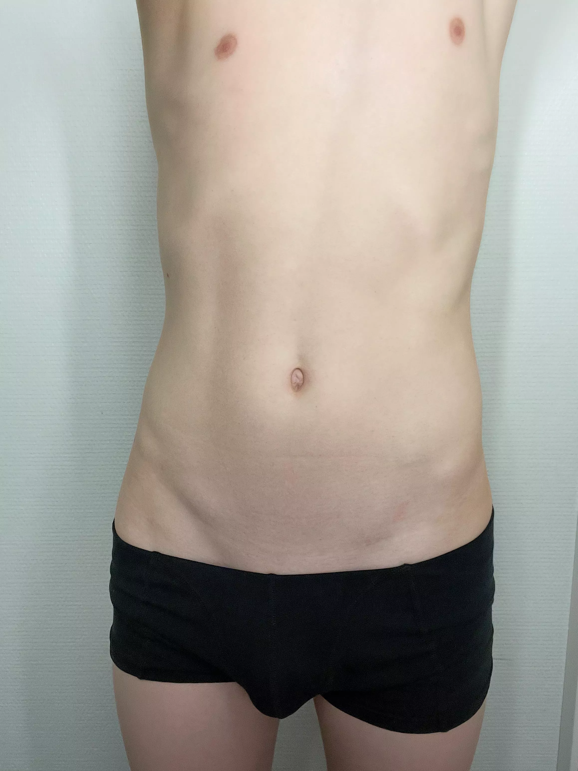 freshly 18yo im not sure of my looks