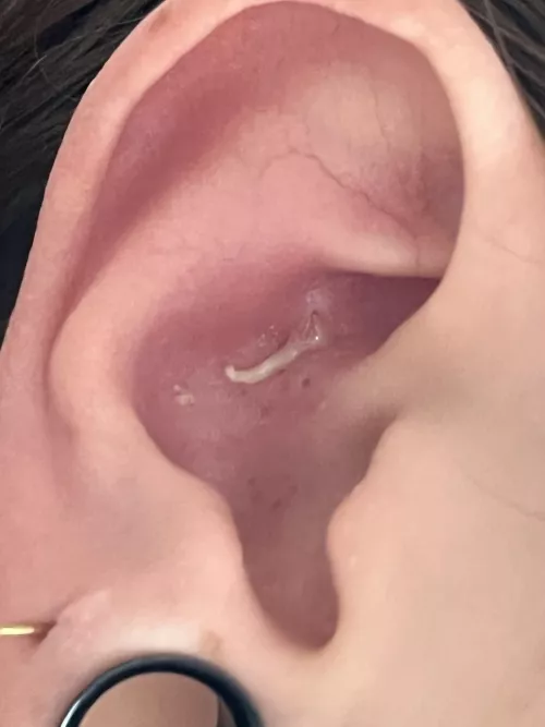 Had a super annoying pimple in my ear for like 3 days, I was messing with it and it finally popped, it was insane lmao. I wish I had filmed it 😩 I had no idea it was gonna give me this incredible pop 😭