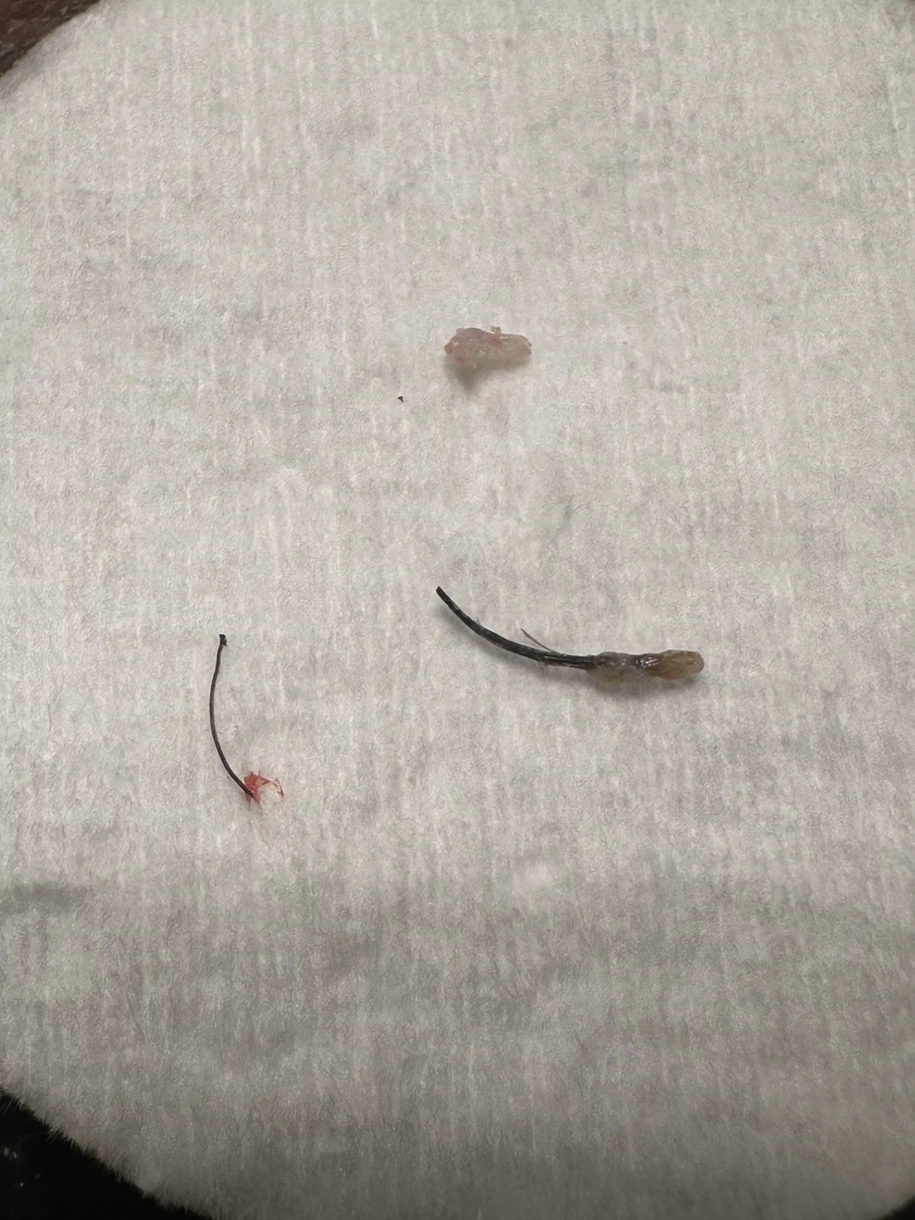 Ingrown hair/pimple ?