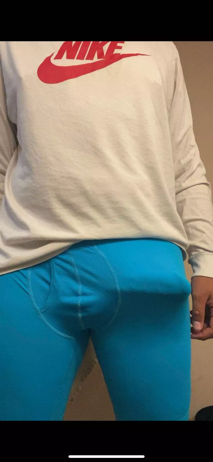 Kiss it?
