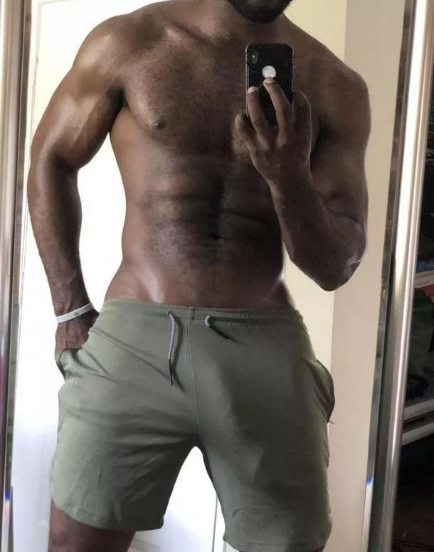 Soft bulge