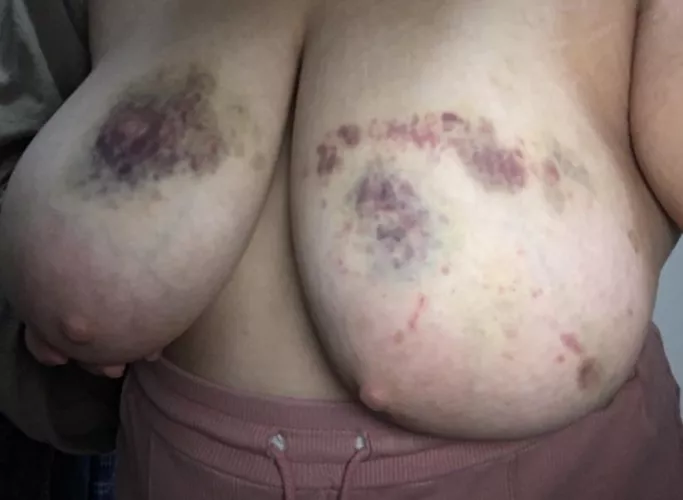 Do you wish it was worse?