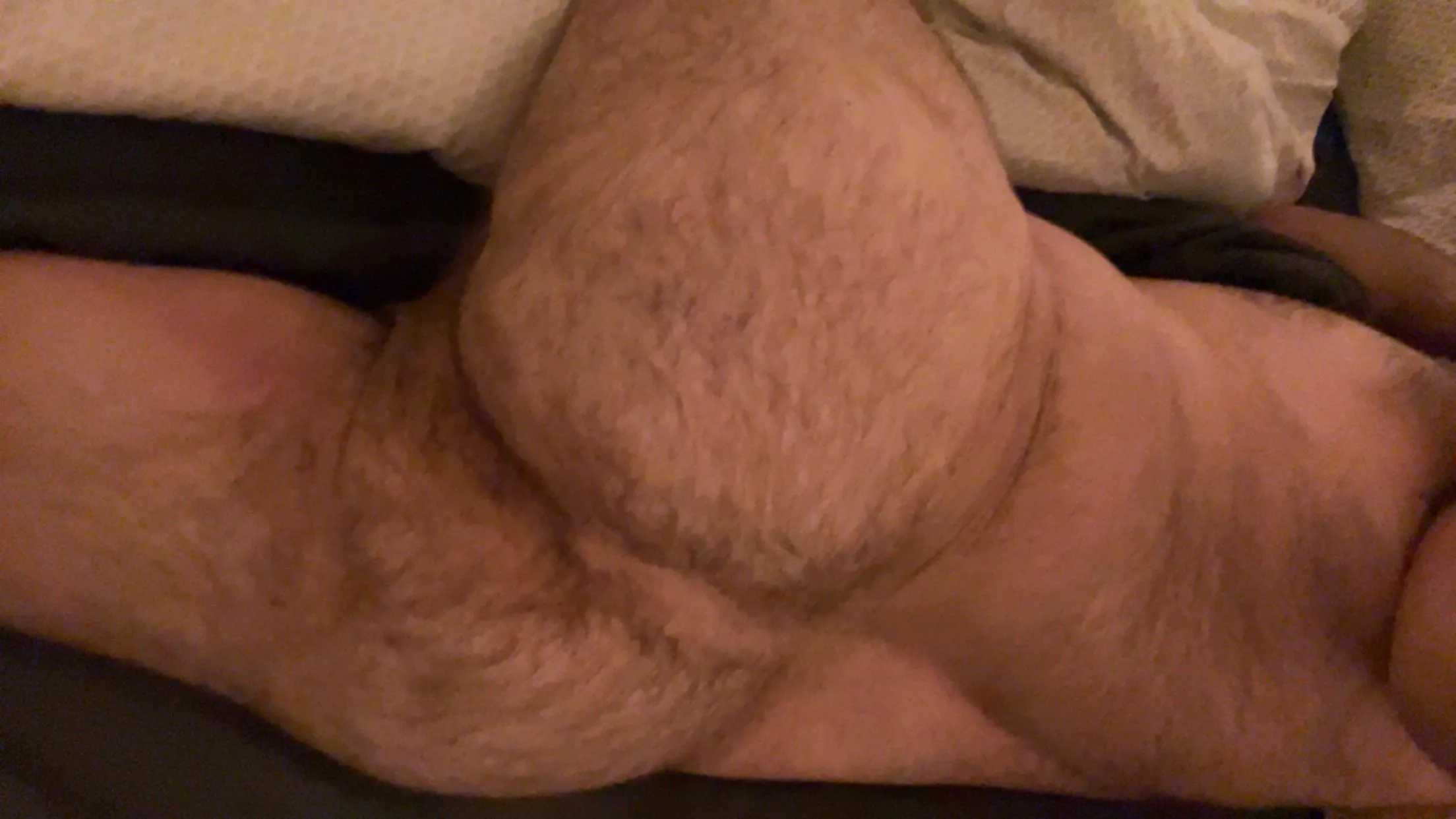 Hairy enough?