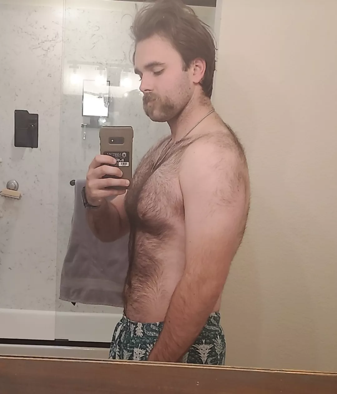 I literally woke up looking like this