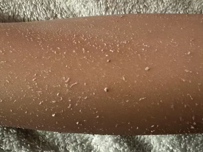 Need Help with Doll Skin Problem