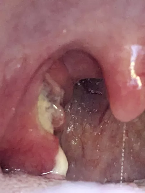 The day after suspected Quincy...