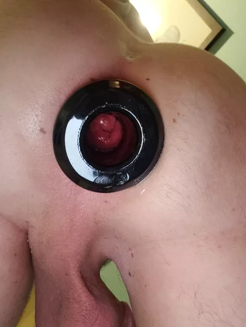 Tunnel plug for the win 