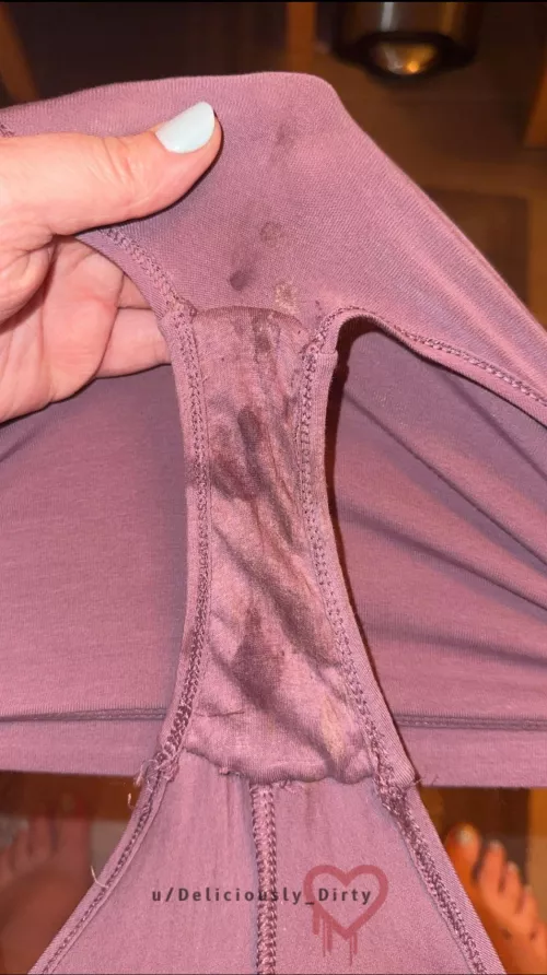 48h Update: I could smell them before I even took them off