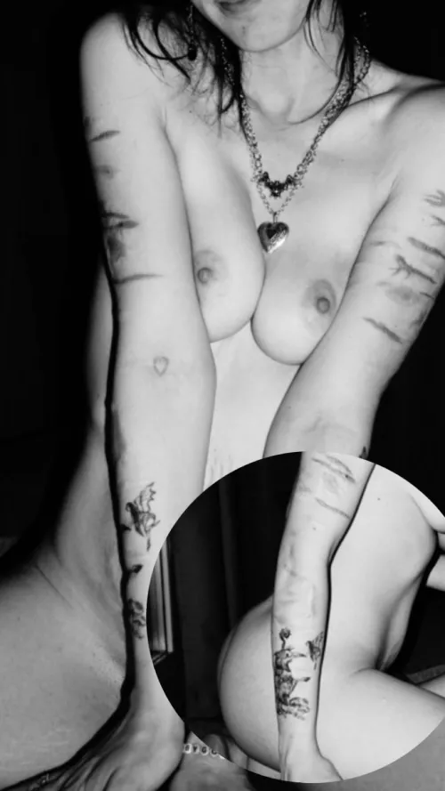 F25, 128 lbs, 5’7 - Scars don’t heal better by being hidden away