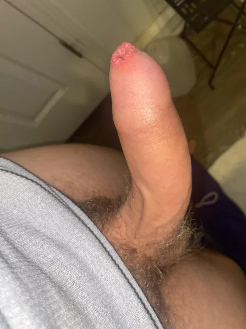 rate