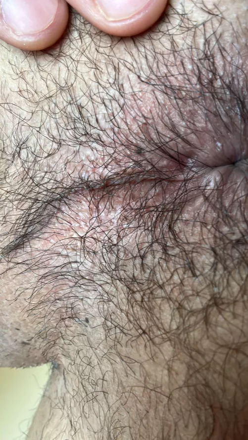 Hairy ass zoom in. Twink 25