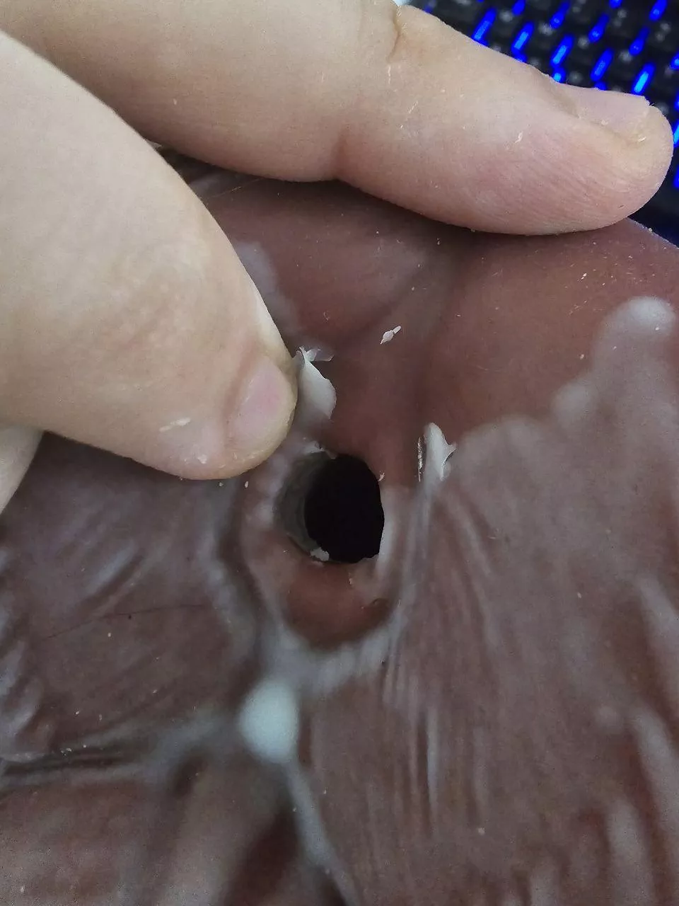 Layers of silicone peeling off my Snowball, what can I do?