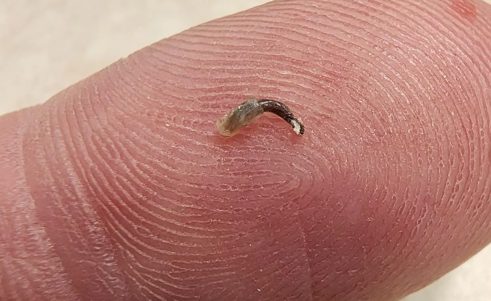 I just pulled this monster out of my cheek.