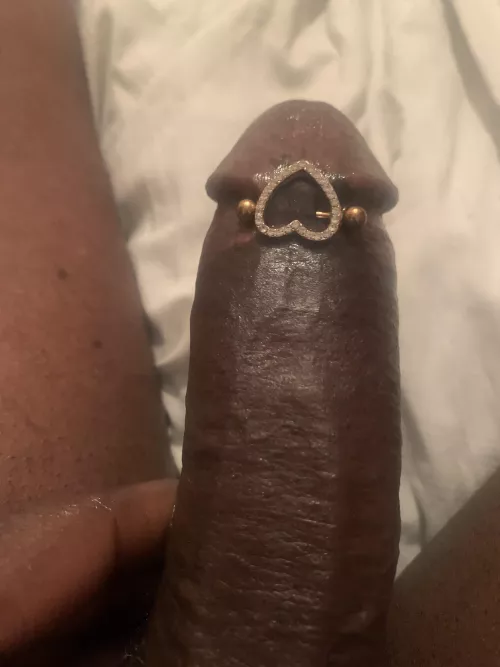 Who’s gonna remove this ring?