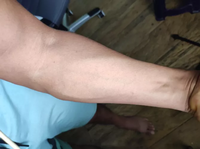 A good forearm squeeze 