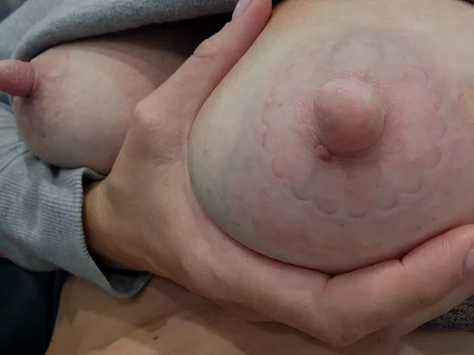 Engorged and lopsided 