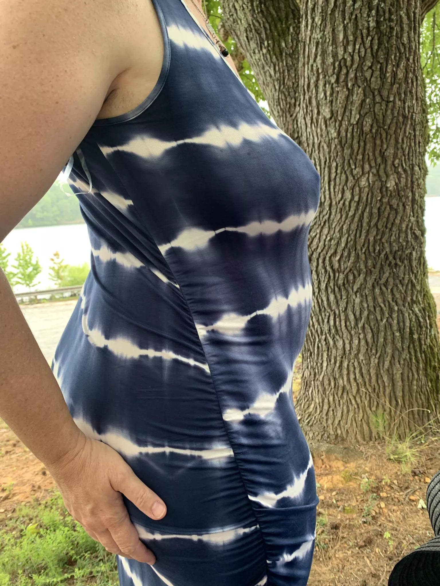 Her sun dress got some looks at the public park