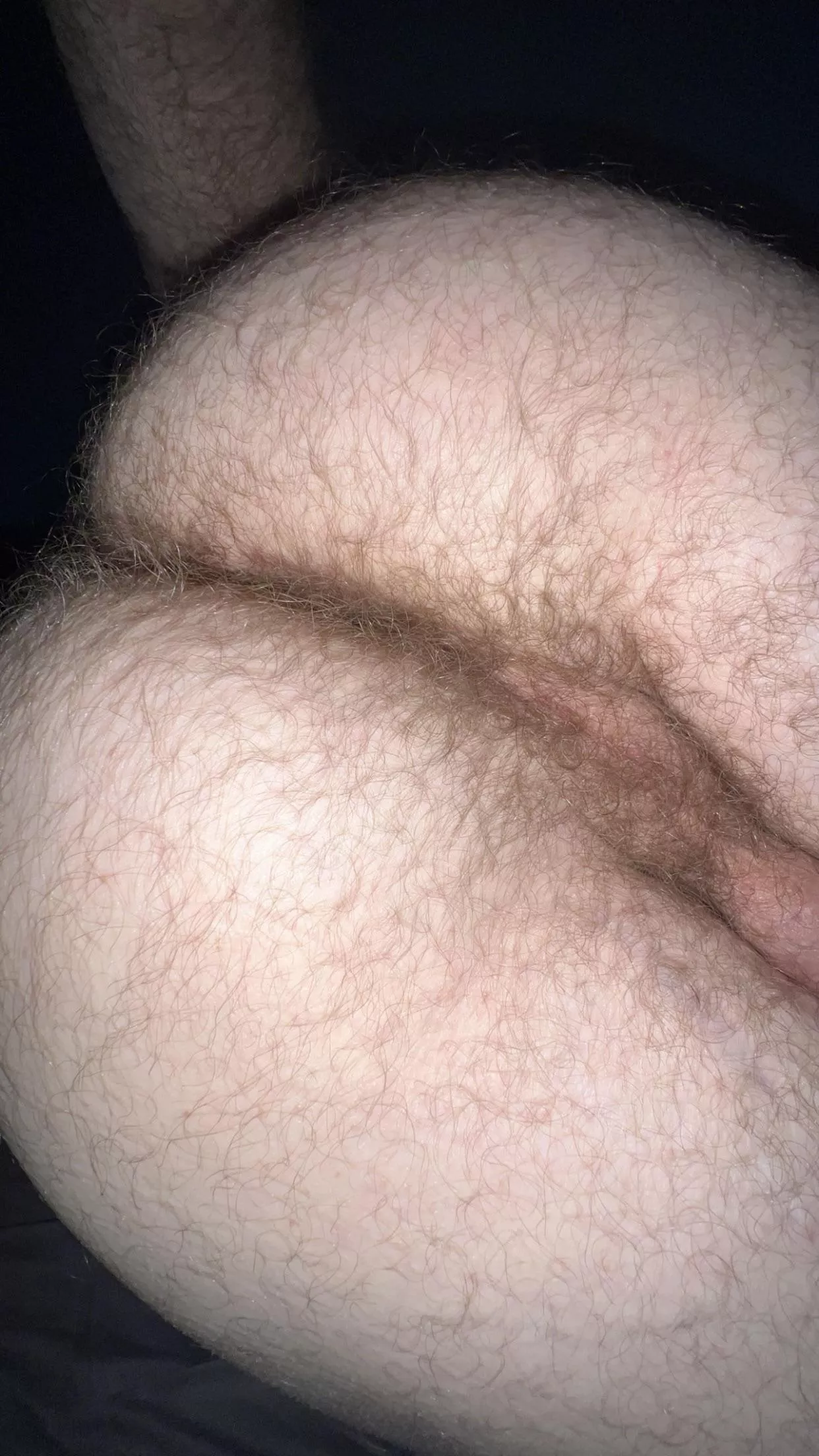 I'm so dang hairy in between my cheeks 😵‍💫