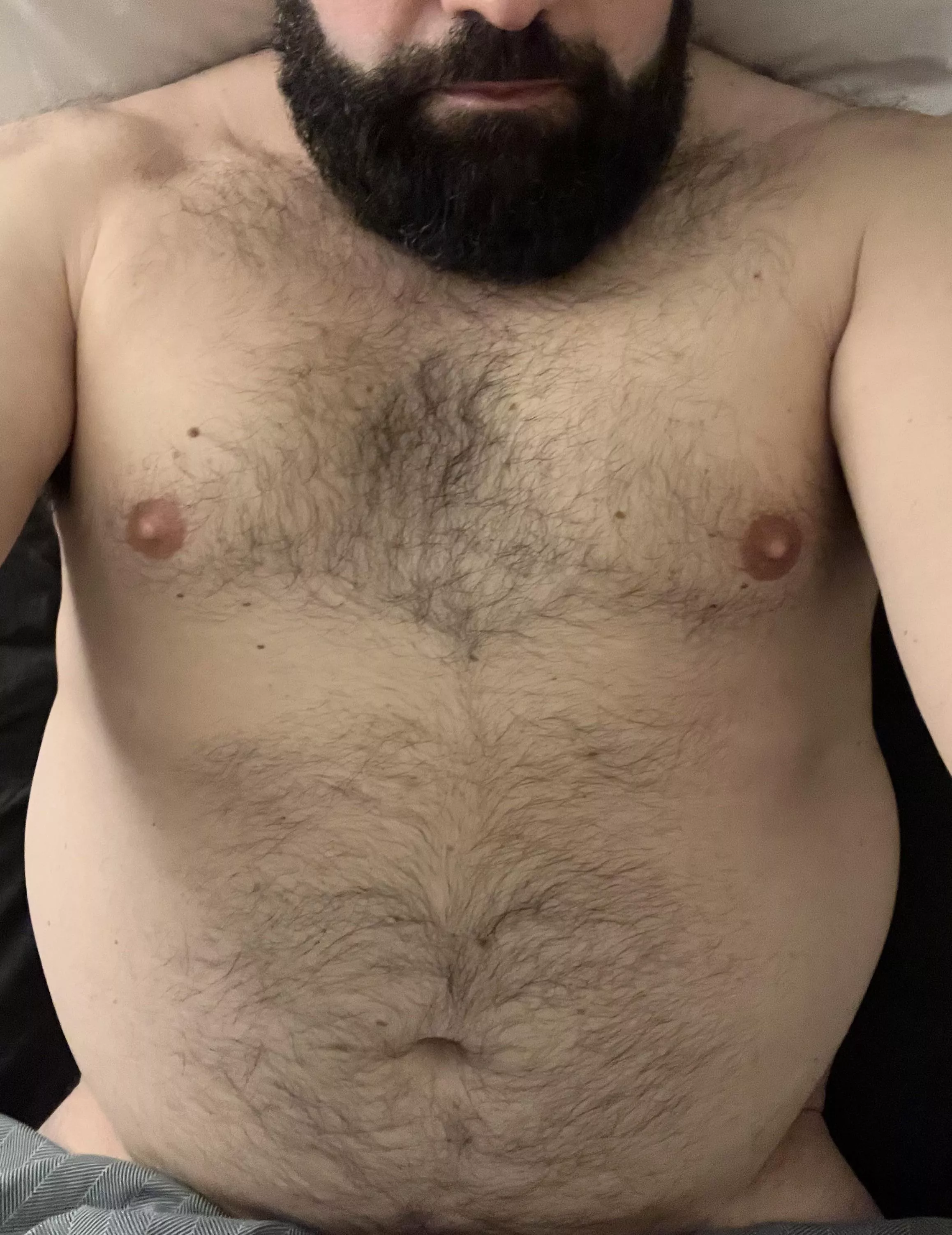 Never posted here - facial and torso hair