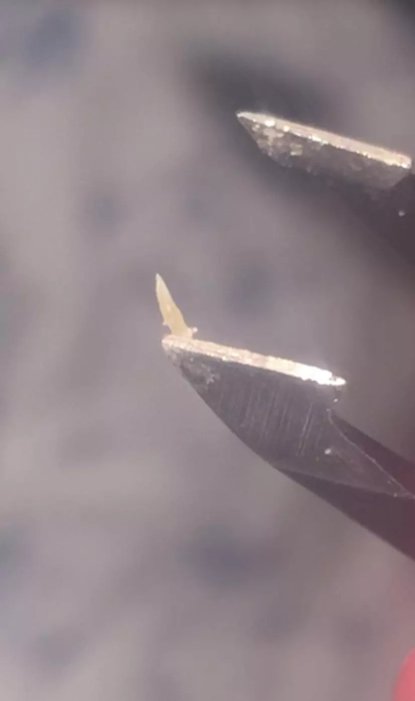 Pulled this blackhead out of my stomach. It always comes back in the same spot