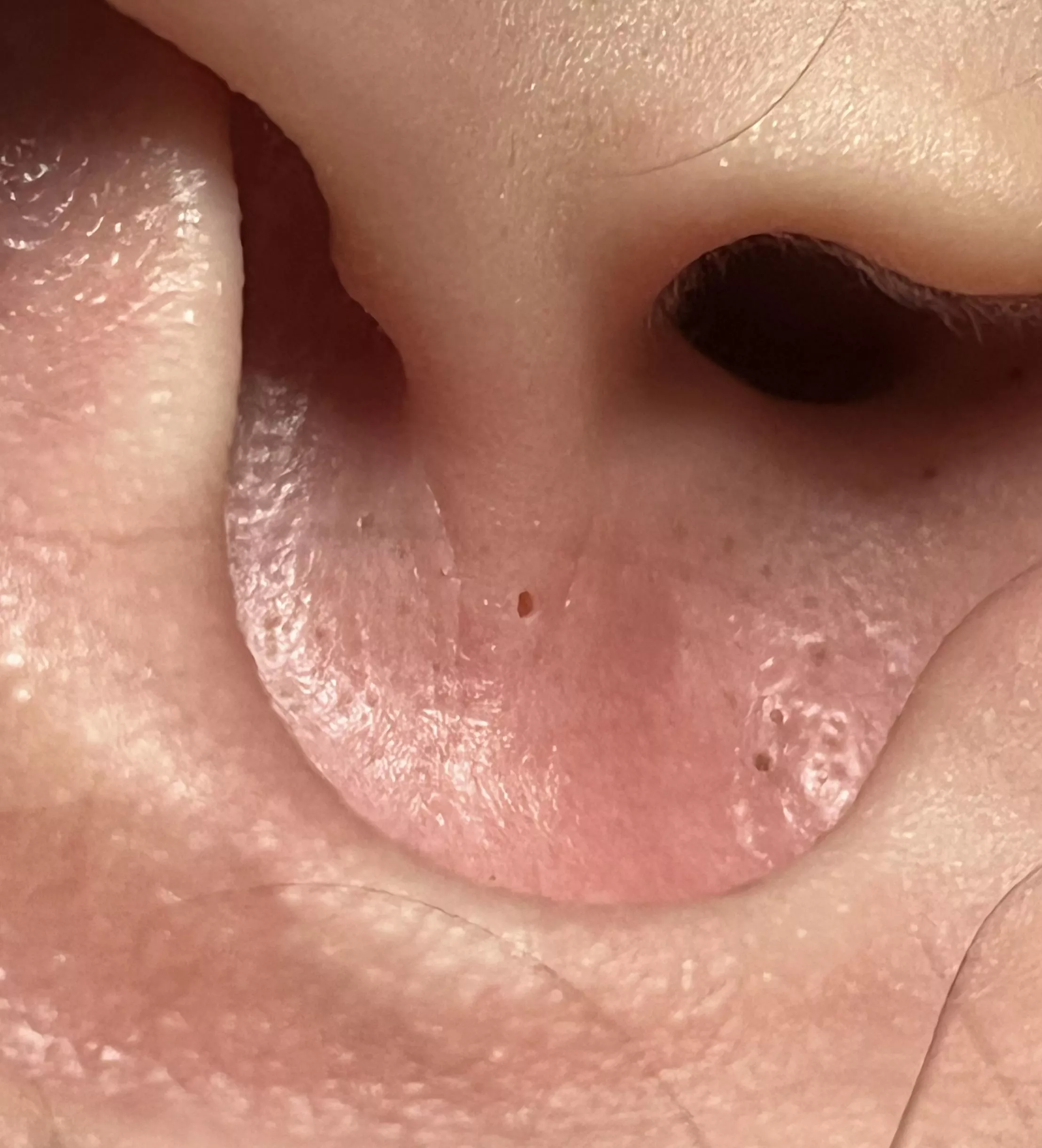 Remembered this hole i left in my friend’s ear