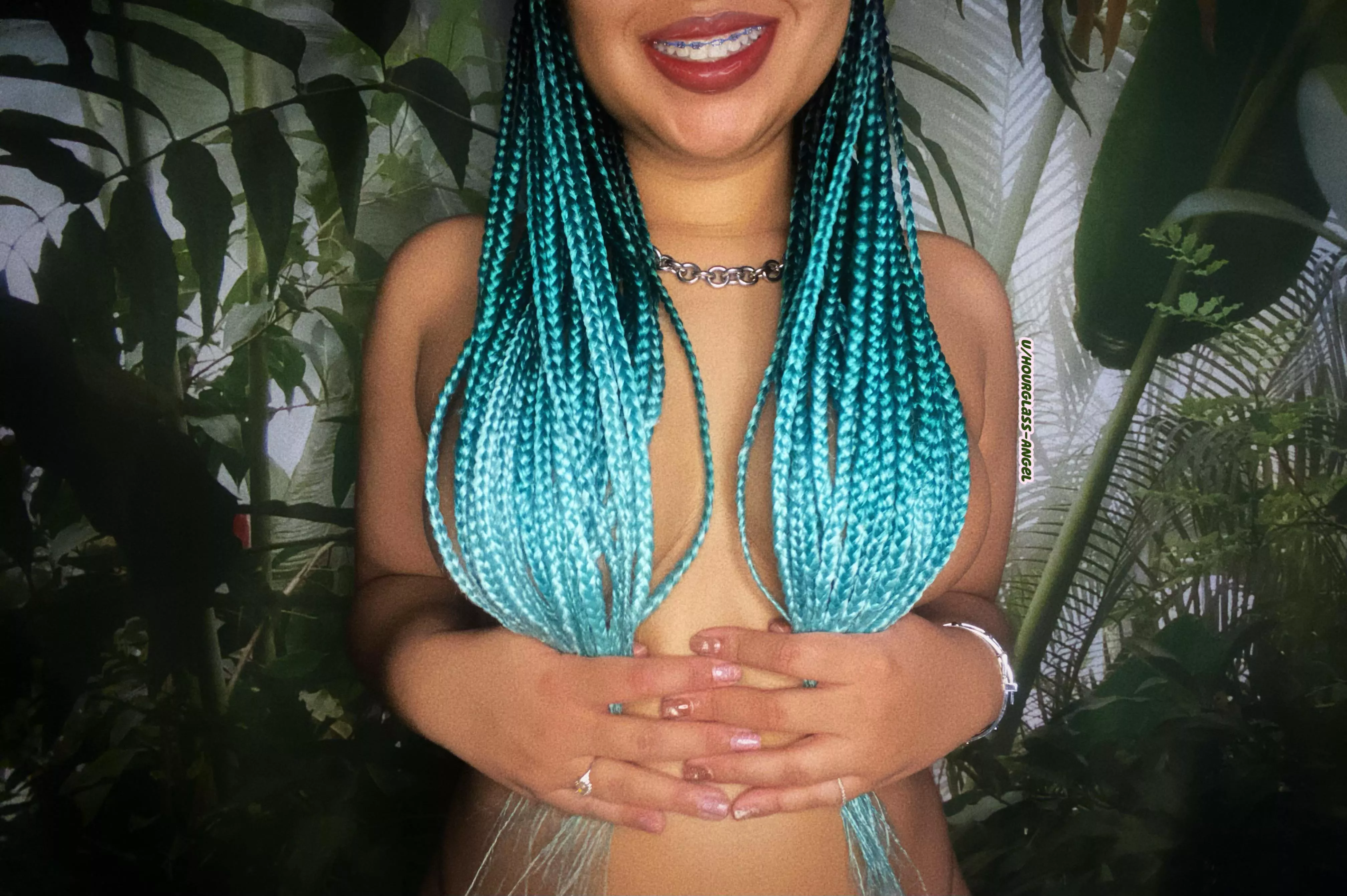 Would you date a girl who had braces?