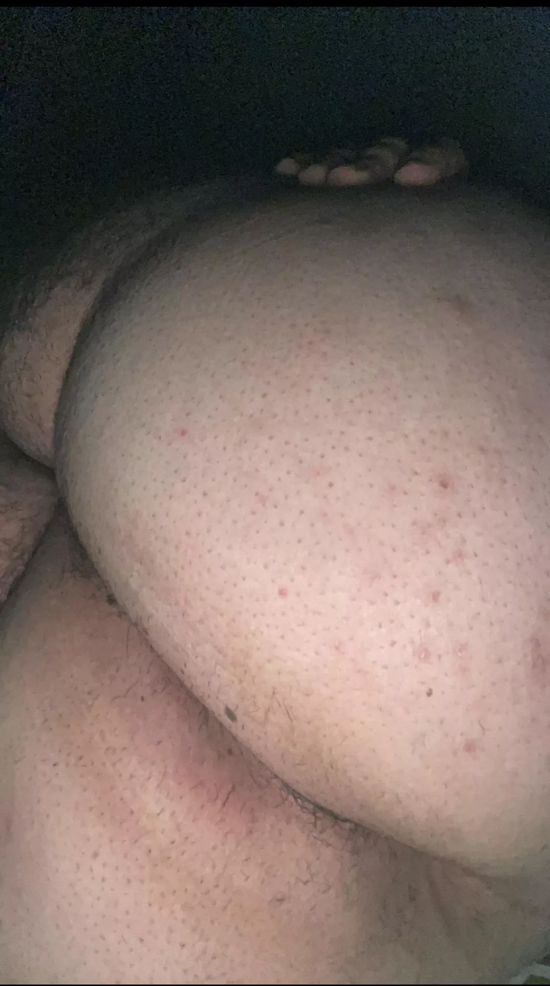 [18] Dropbox with all my nudes in my bio