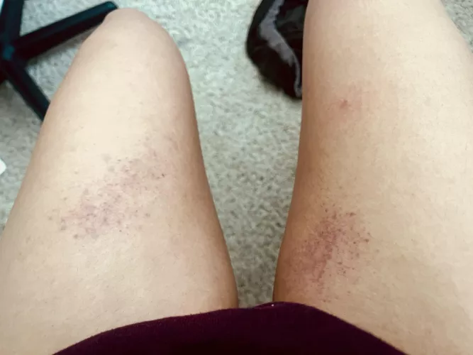 A little thigh spanking