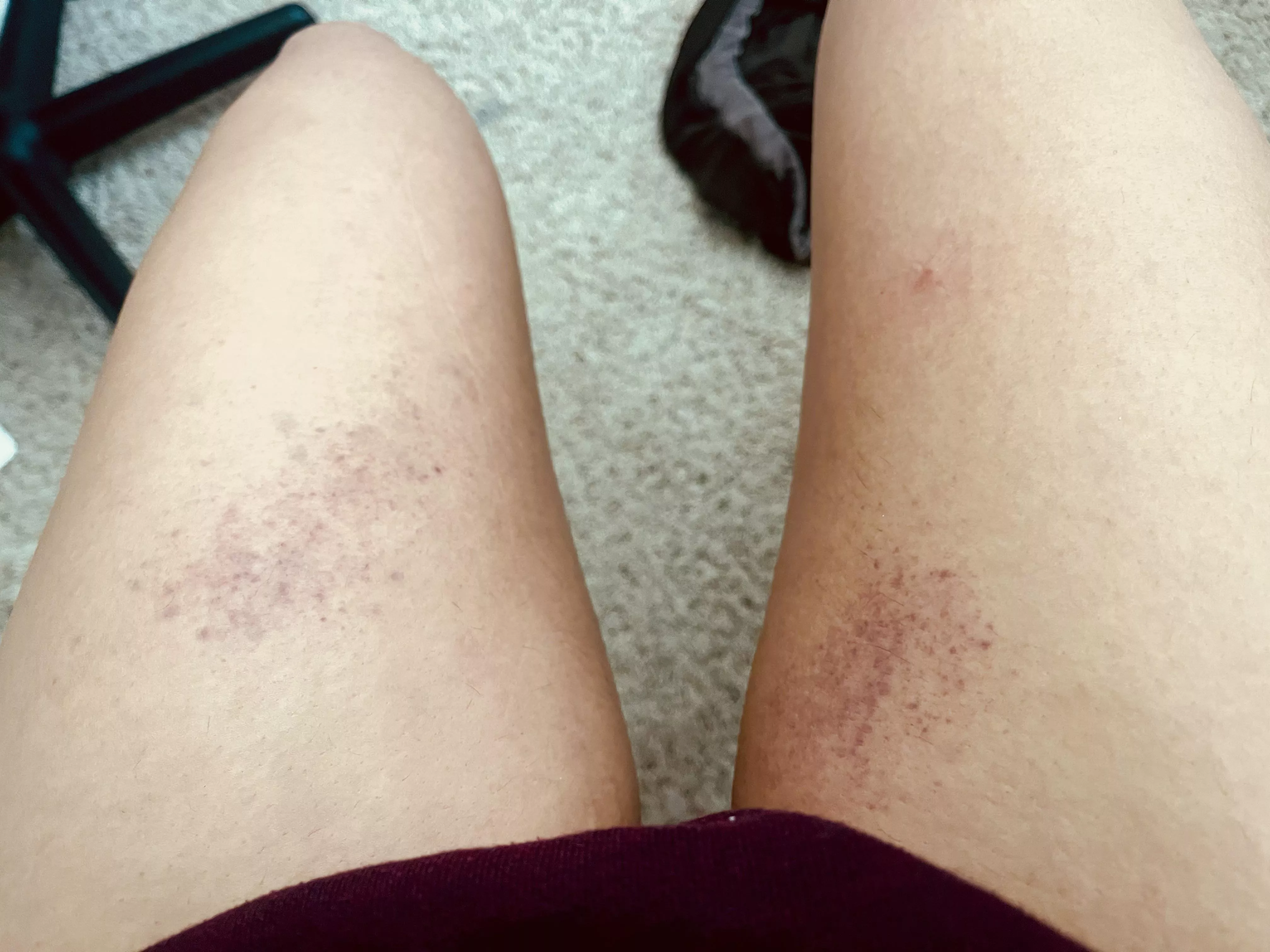 A little thigh spanking