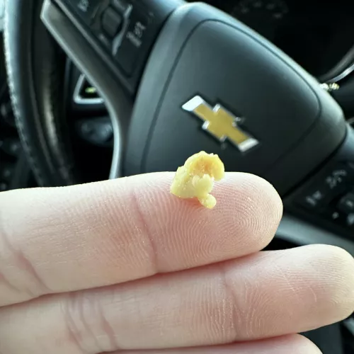 Coughed this up this morning