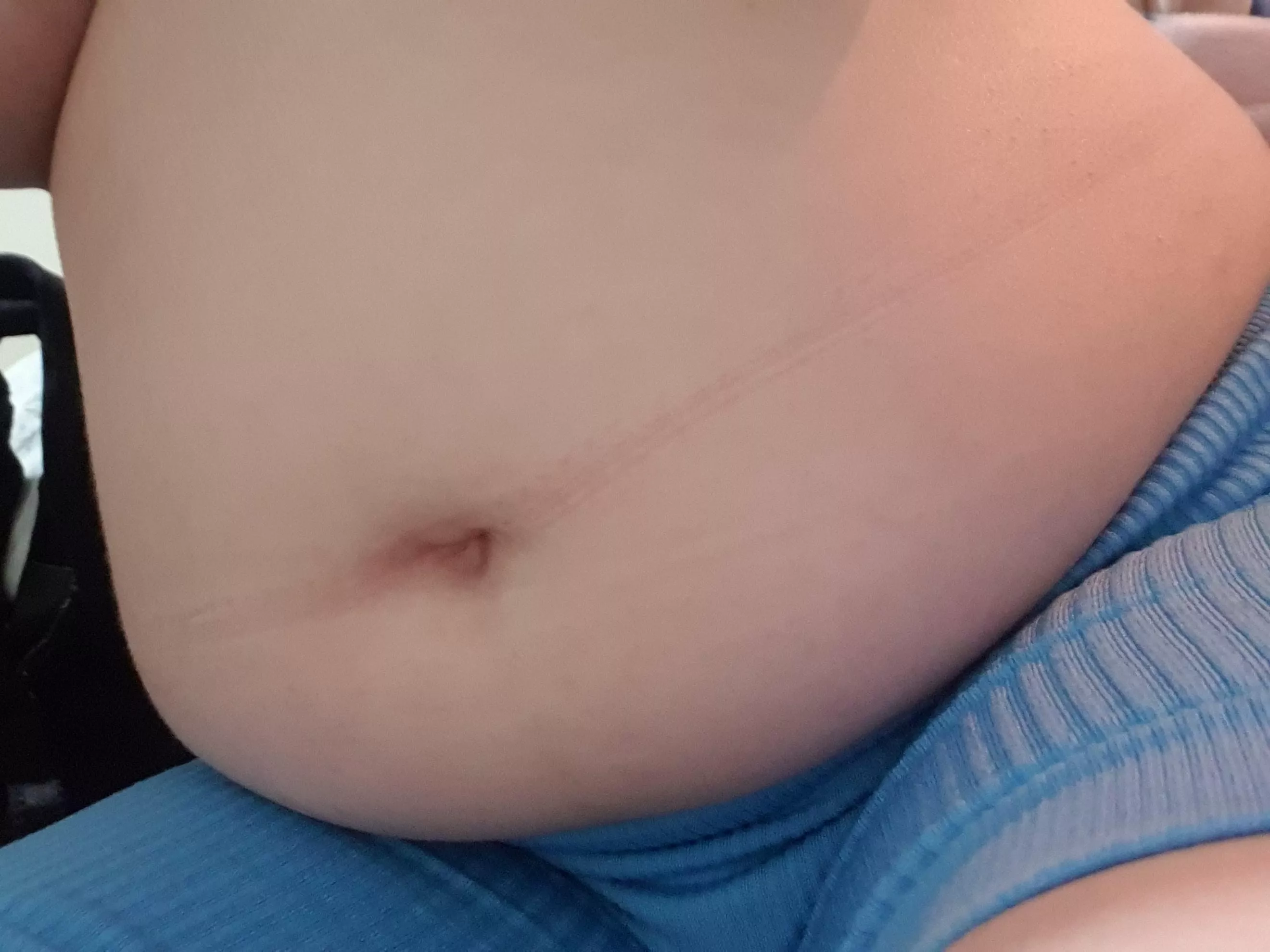 My bellybutton is shaped like a love heart 🥰 it'll give you a kiss if you feed it 