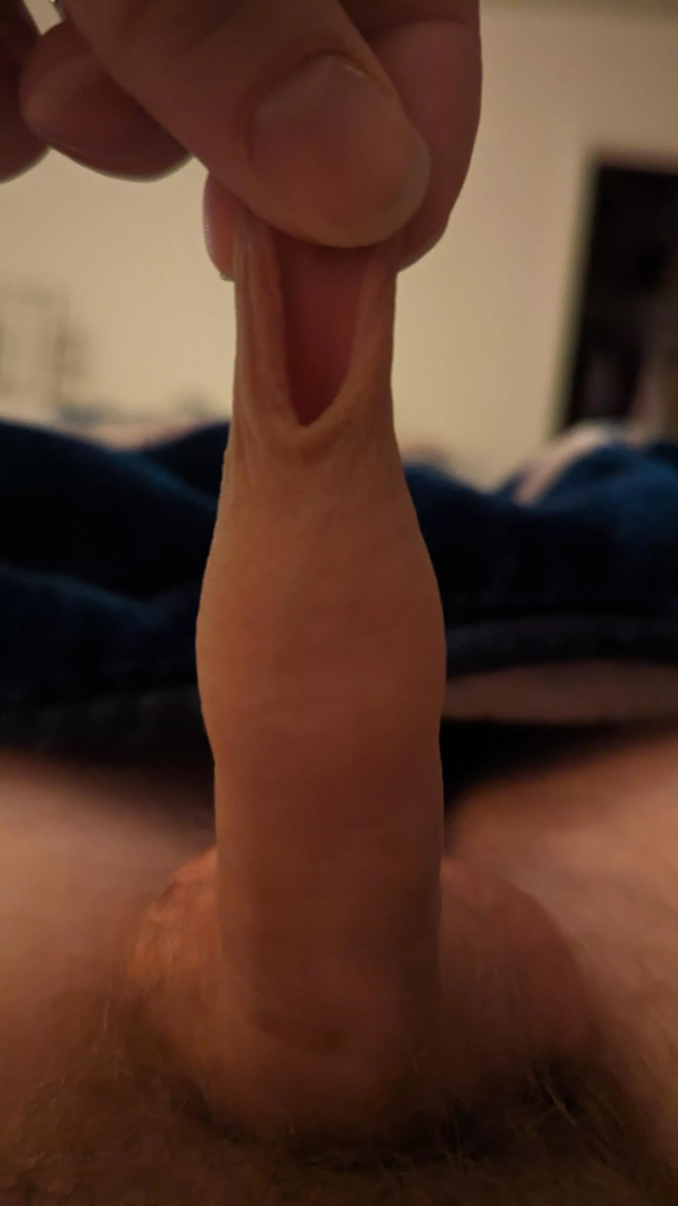 Anyone else like stretching thier  skin out for no reason? 