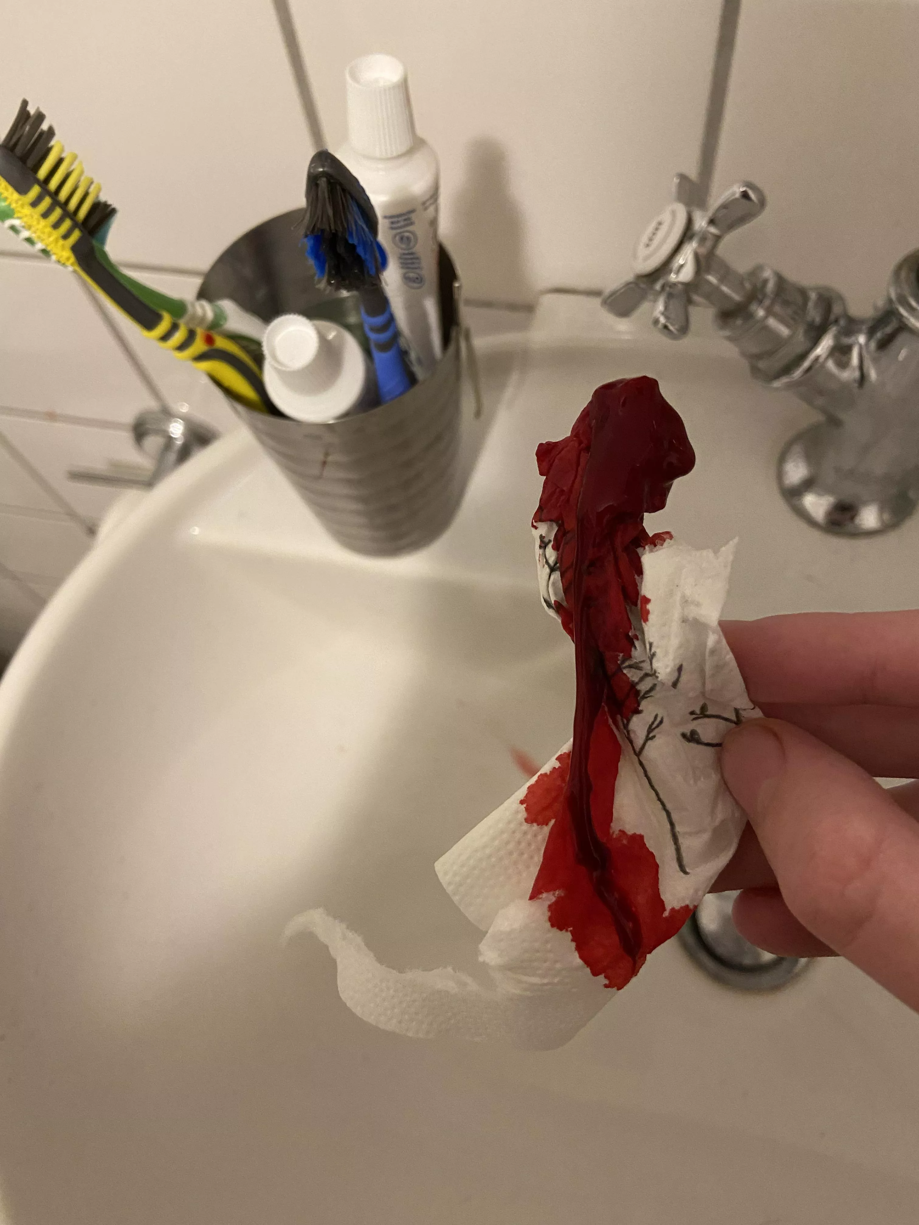 Pulled This out of my nose during a mighty nosebleed