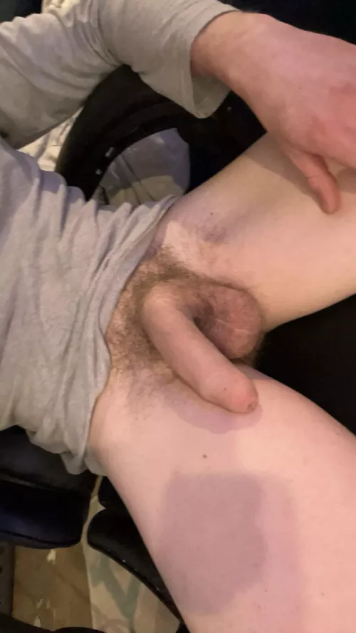 What do u think of my foreskin talk to me in the comments about it I need comment karma lmfao 