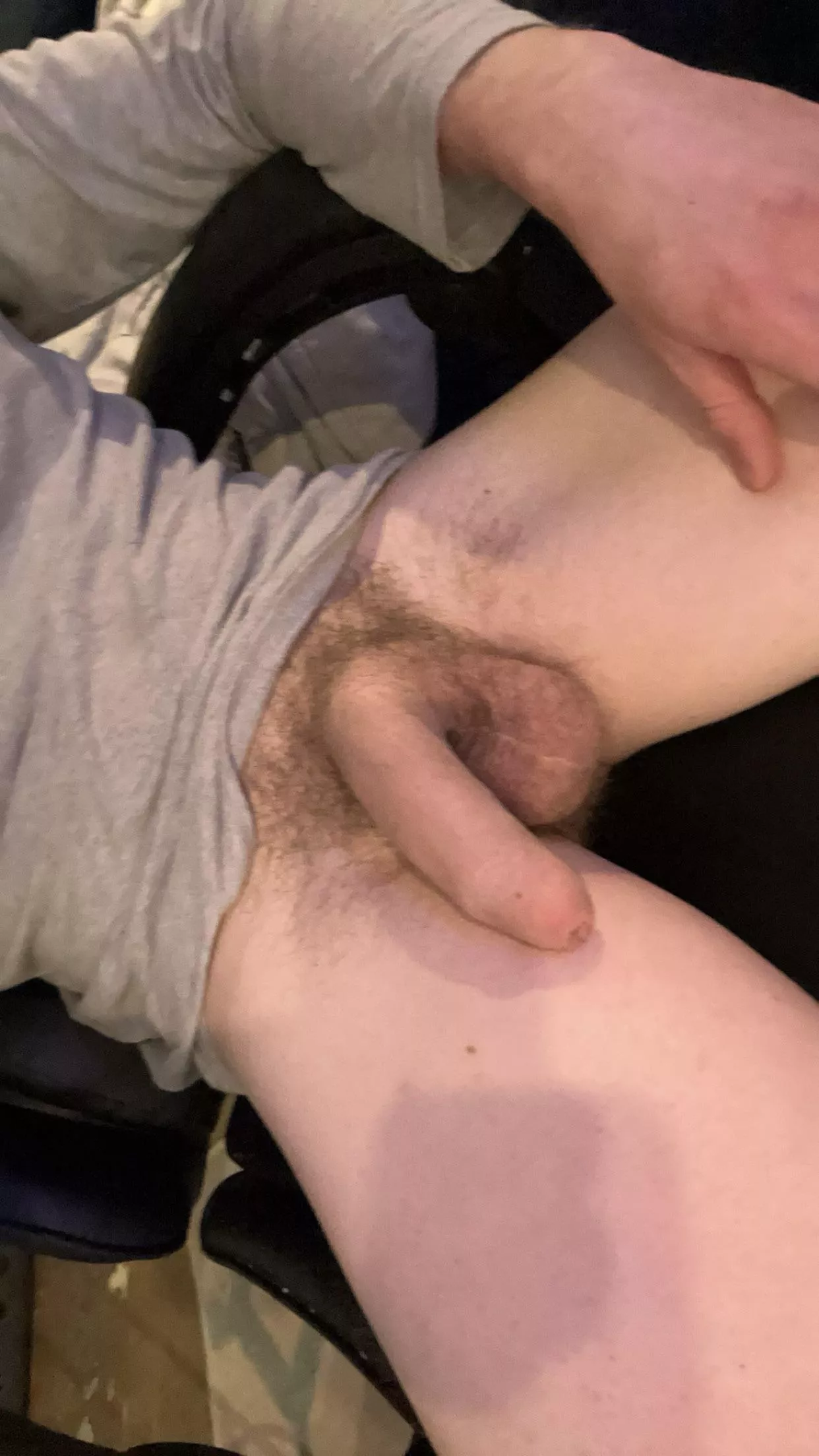What do u think of my foreskin talk to me in the comments about it I need comment karma lmfao 