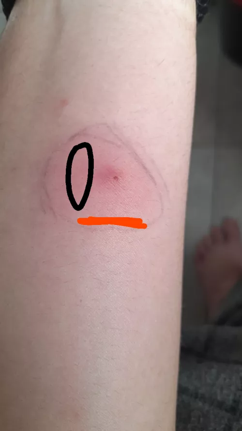 What is this?, should i be worried