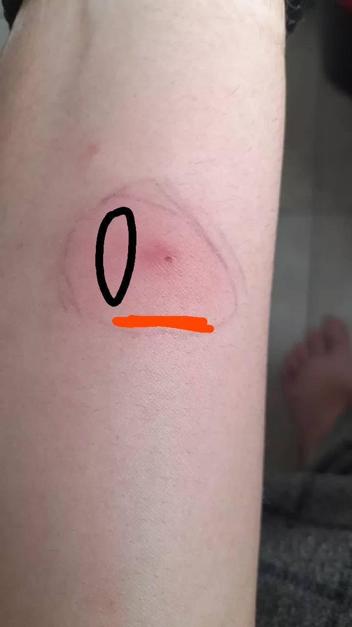 What is this?, should i be worried