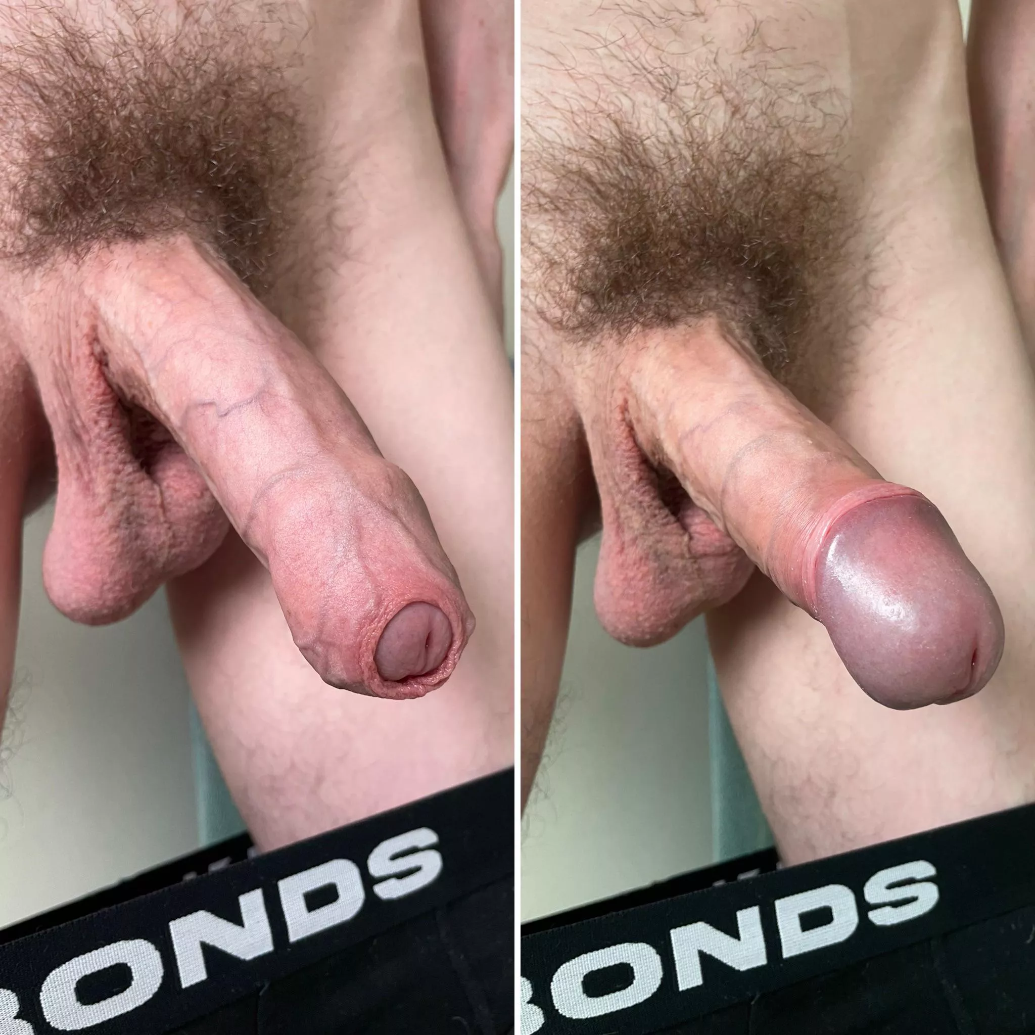 Best of both worlds 🙈🙉