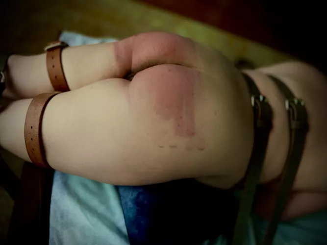 Whoops I did it again - tawsed over bruises [f]