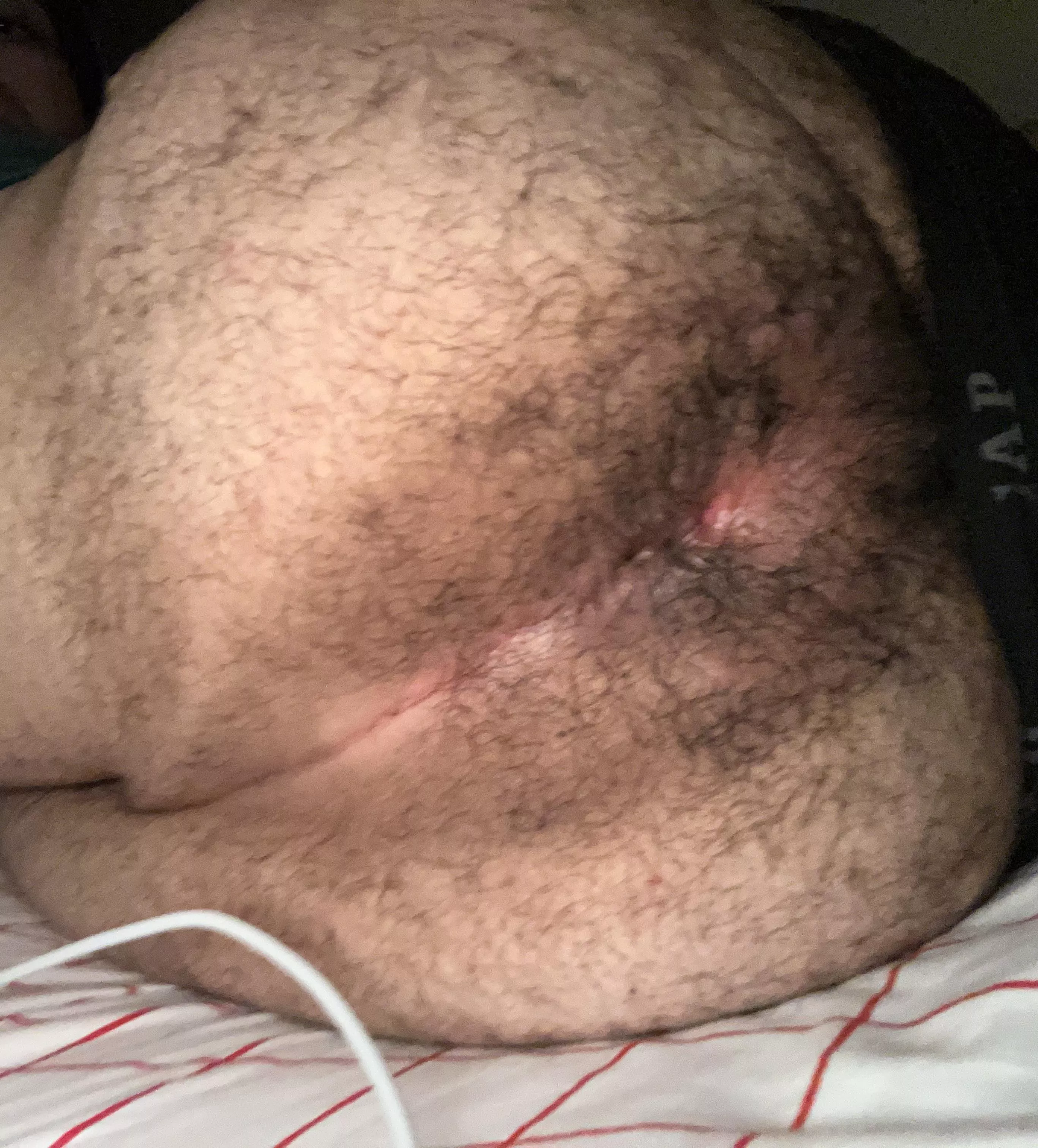 20 hairy chubby bottom add my snap js80712