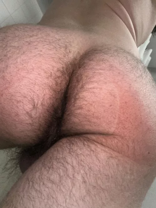 Hairy