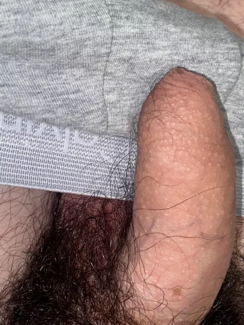 I get some hairs in my foreskin... is it common? Comments are really welcome 