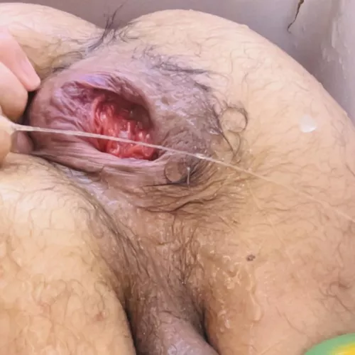 Need fem partner to help with my hole 🕳️ 