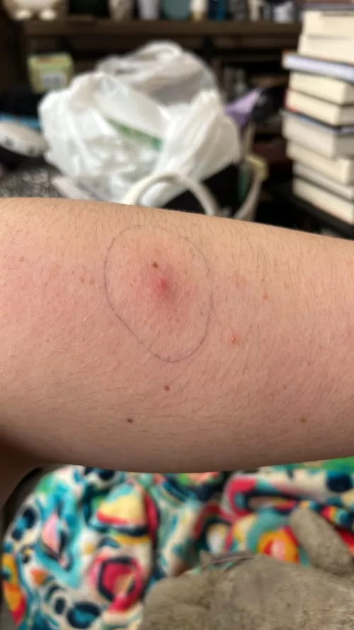 Now.. The Waiting Game 